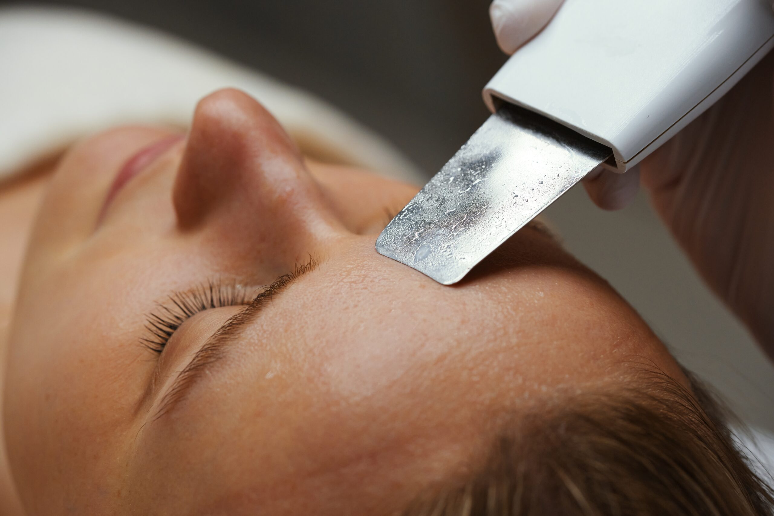 dermaplaning